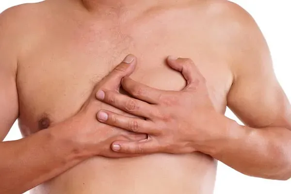 Gynecomastia