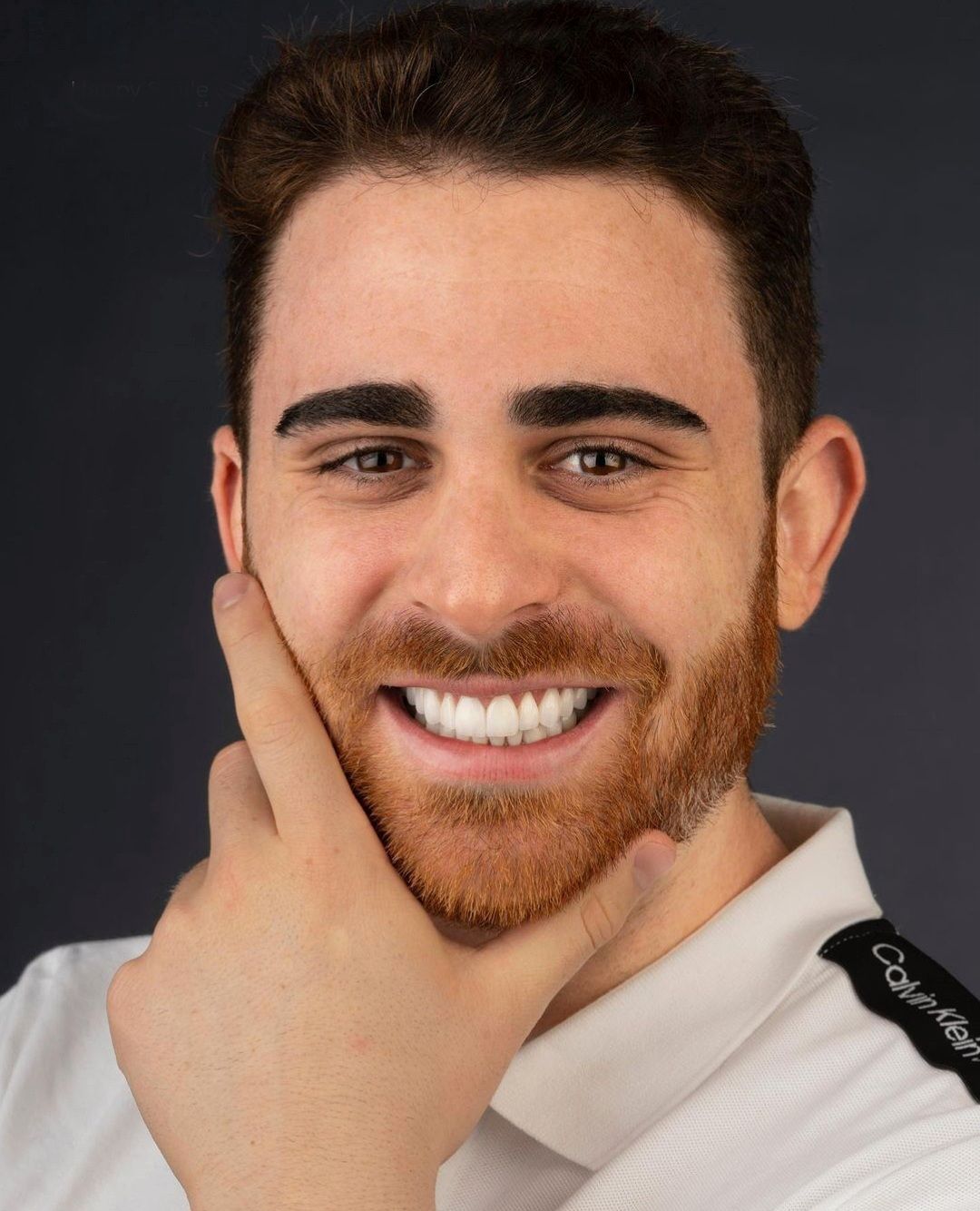 Teeth of a young man after dental veneers, white teeth