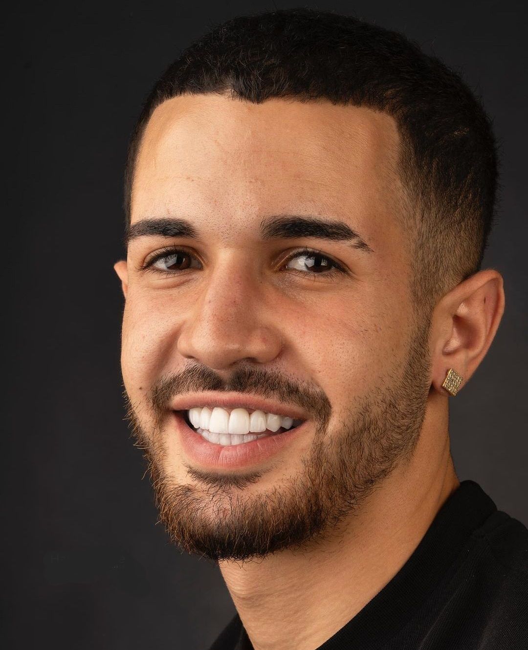 A young man with his new white teeth after Hollywood Smile
