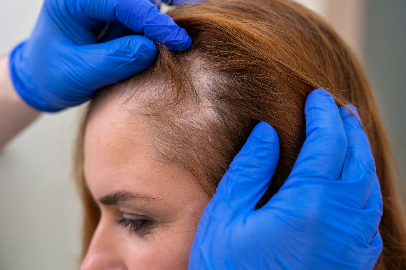 Hair Transplant Specialist inspecting an old woman's receding hair