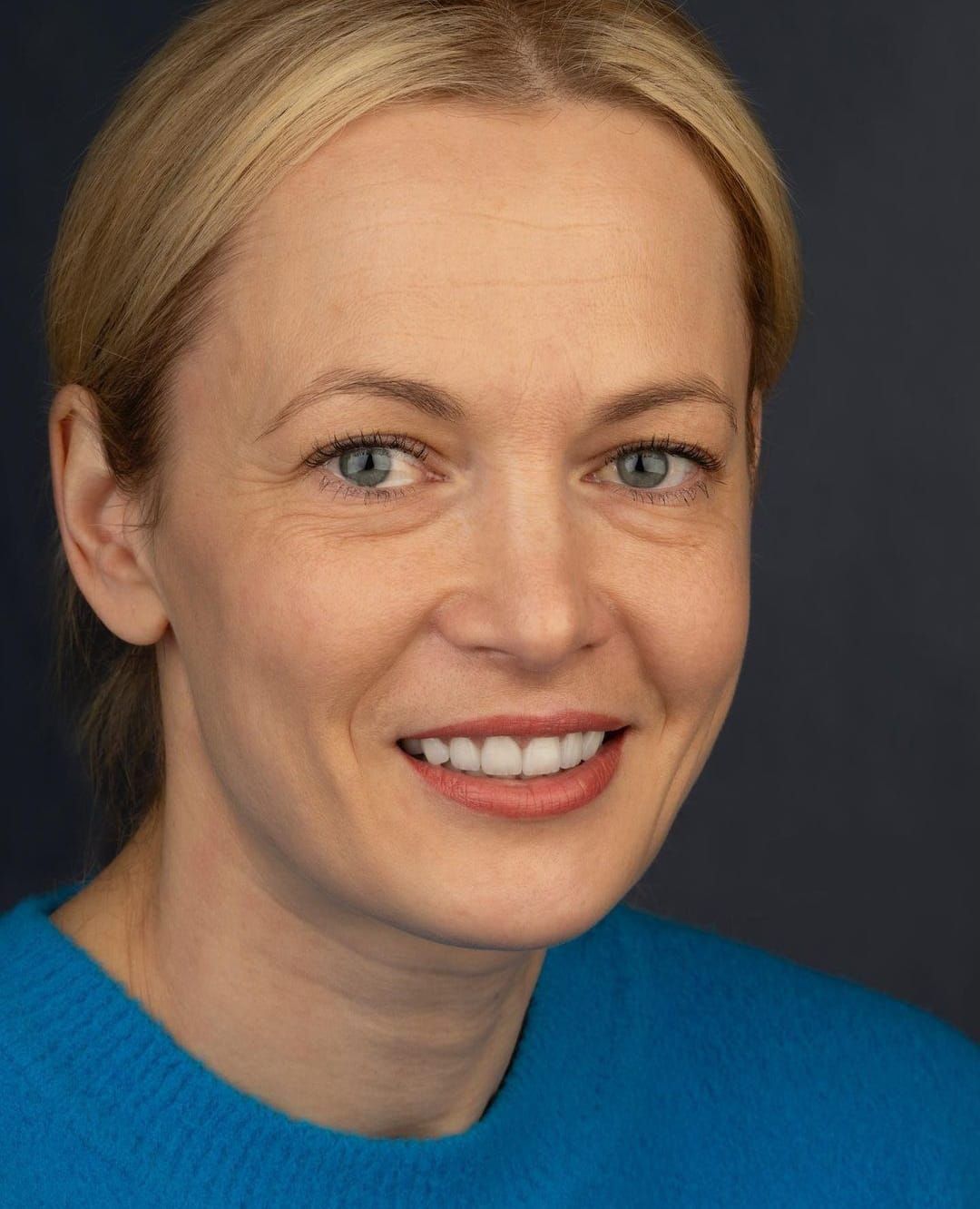 Smiling Woman with White Teeth