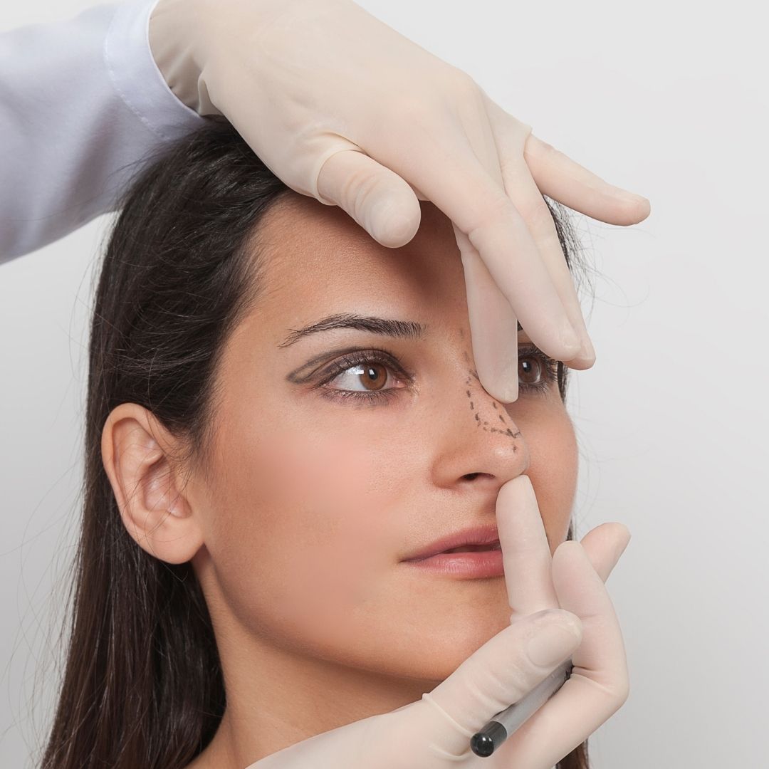 A Woman is getting examined before Rhinoplasty