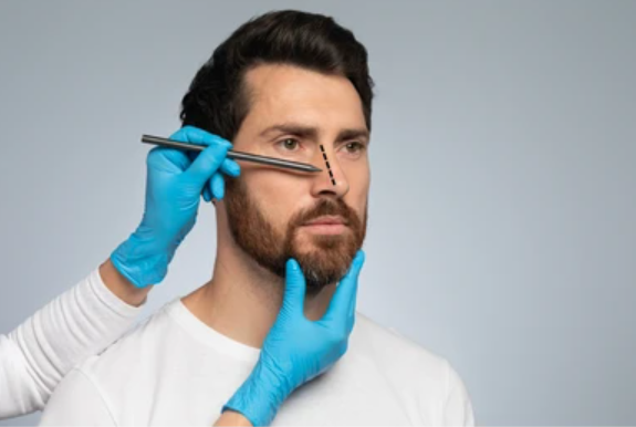 A doctor is marking a male patient before the rhinoplasty