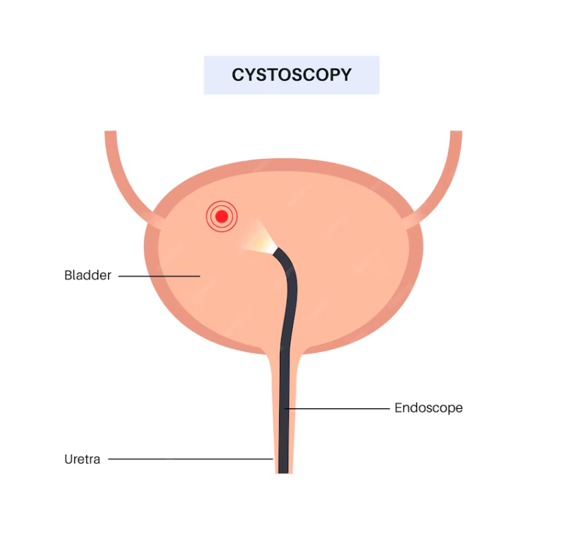 Cystoscopy Drawing