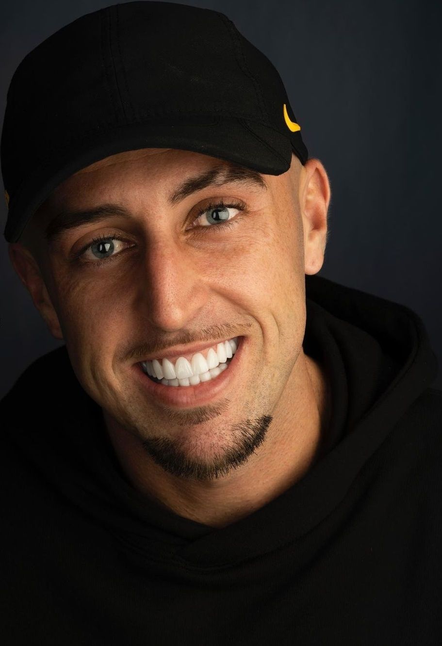 A young man with Dental Veneers White teeth