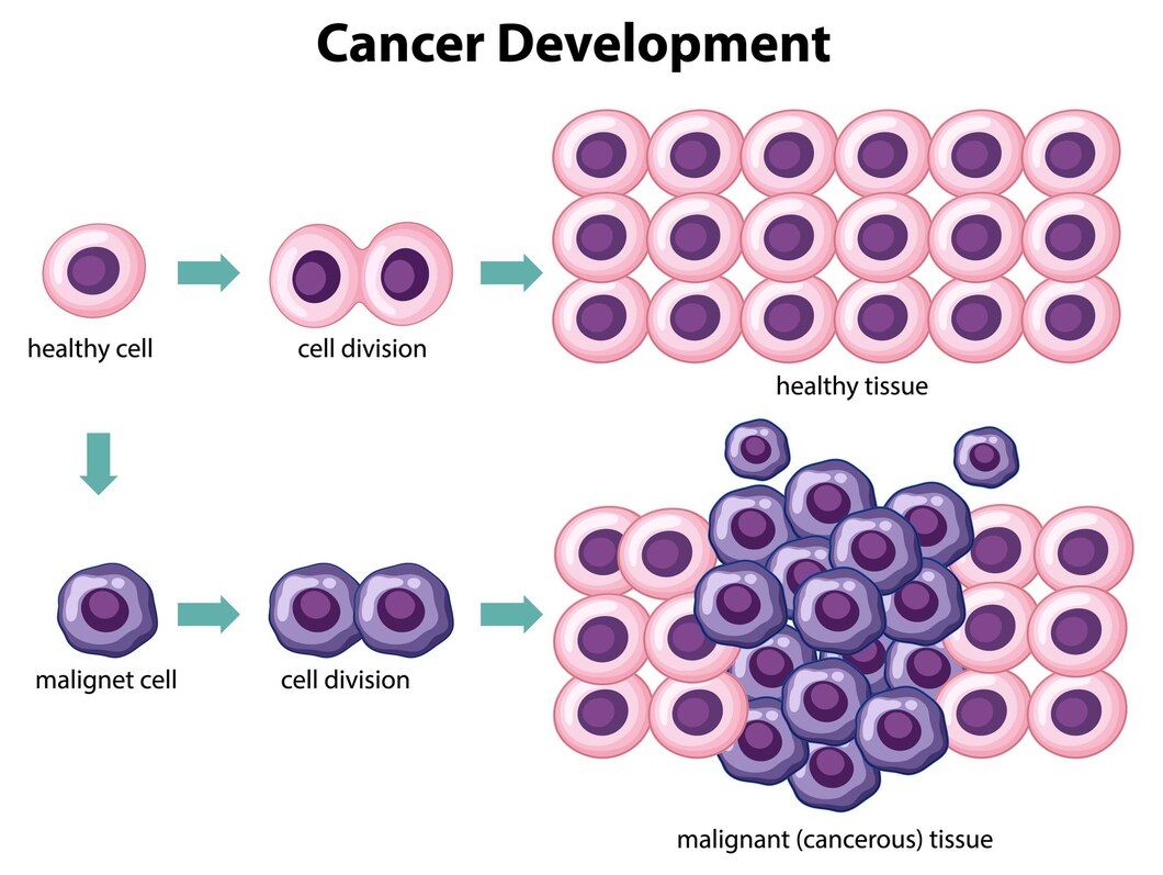 Development of Cancer