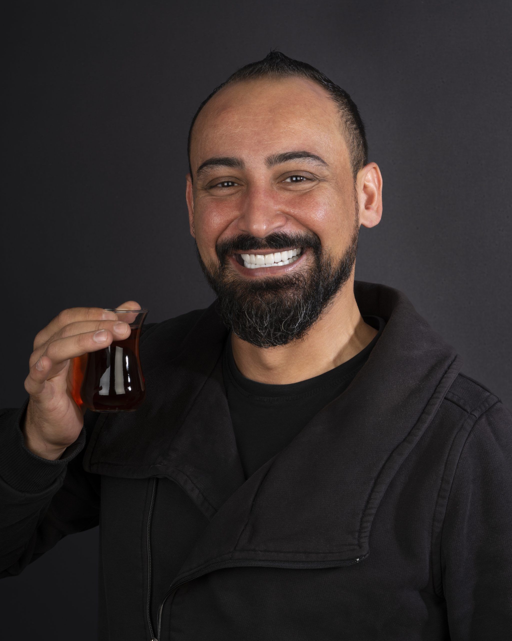 A young man got white teeth and Hollywood Smile thanks to his smile design 