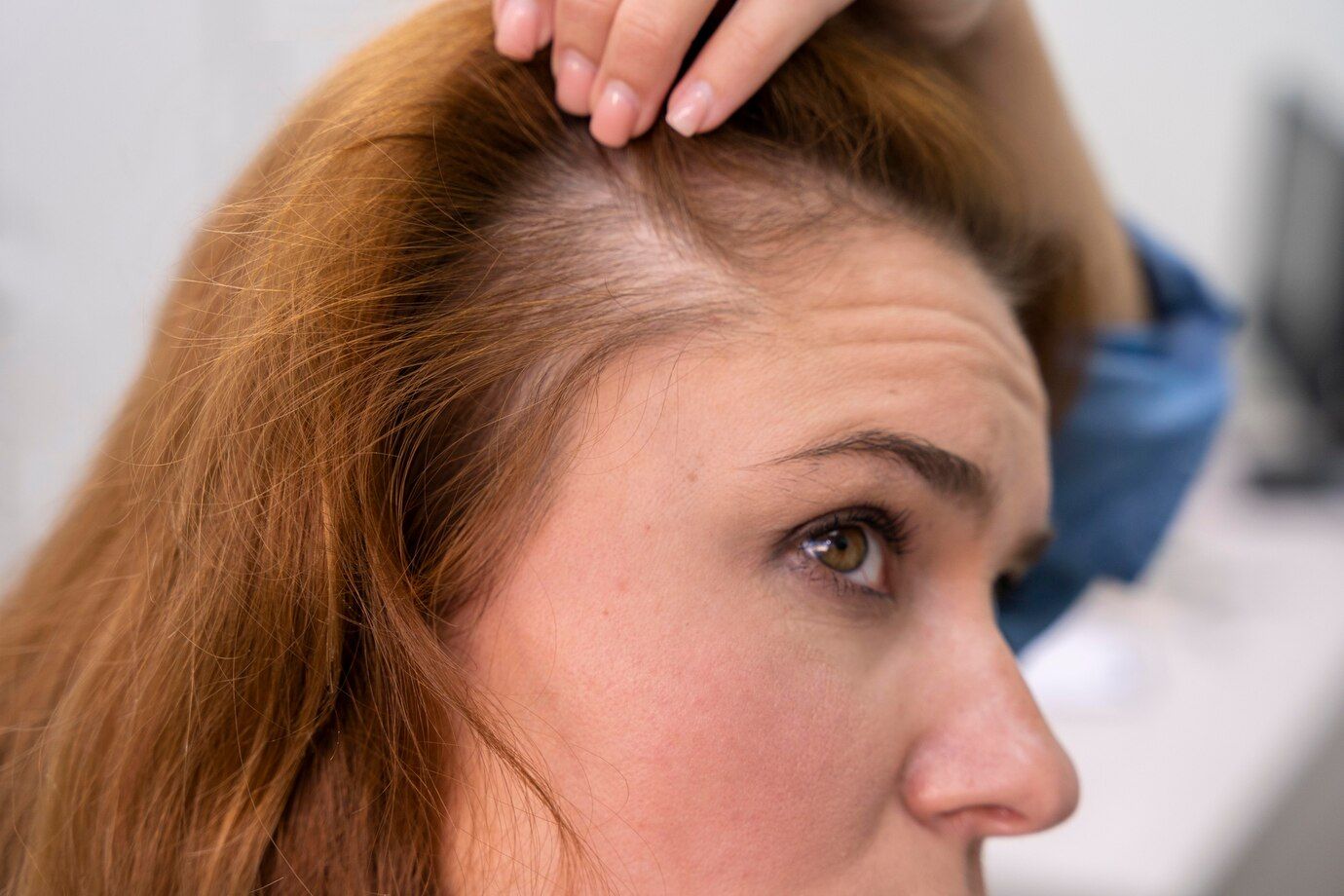 Hair Transplant Specialist inspecting an old womans receding hair