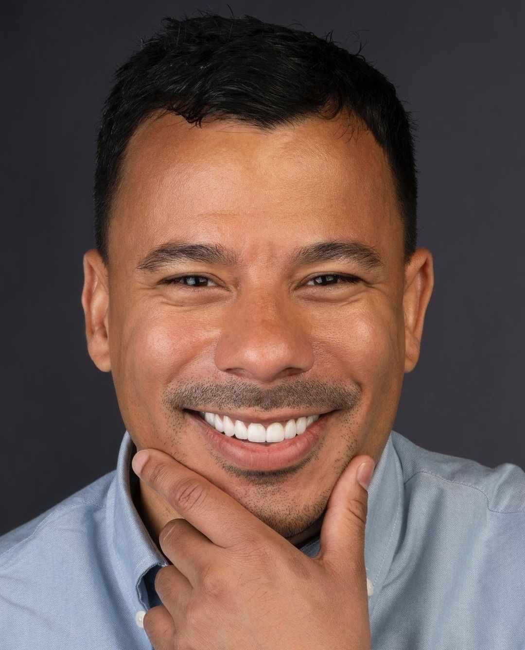 White Teeth of a young man after his smile design. Hollywood smile