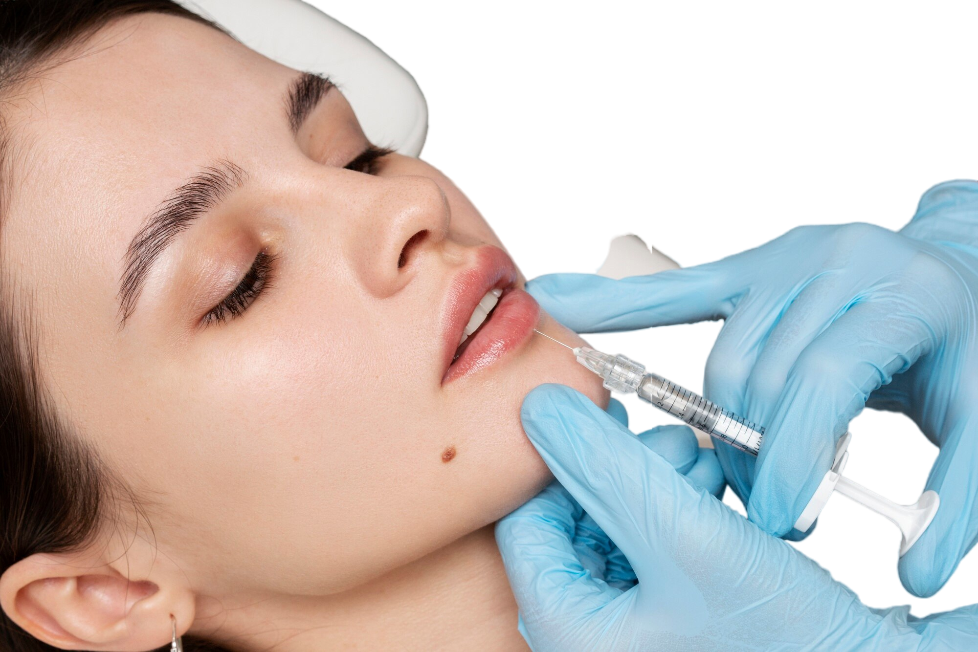 A specialist marking a mans bald spot before his hair transplant surgery